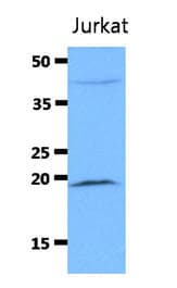 DIABLO / SMAC Antibody (clone AT19F2)
