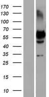 OC90 Protein (Over-Expression Lysate Myc-DDK (Flag))