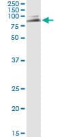 MUTYH / MYH Antibody (clone 4D10)