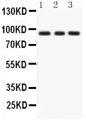 PRKCE / PKC-Epsilon Antibody (aa53-236)