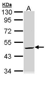 IHC-plus™ Polyclonal Rabbit anti-Human KRT20 / CK20 / Cytokeratin 20 Antibody (aa75-317, IHC, IF, WB)
