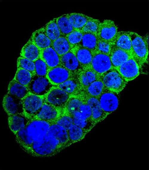 Polyclonal Rabbit anti-Human C1QG / Complement C1QC Antibody (aa93-120, IHC, IF, WB)