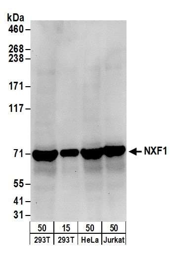 EXOSC9 / p5 Antibody (aa389-439)