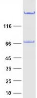 Human GOLM1 / GP73 / GOLPH2 Protein (Recombinant Myc-DDK (Flag))