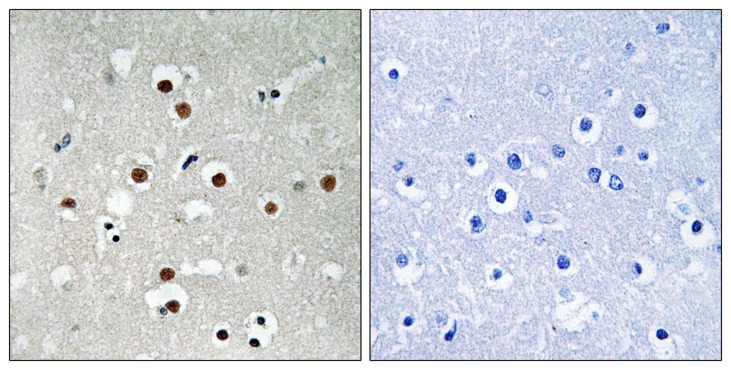 MEF2C Antibody (phospho-Ser396)