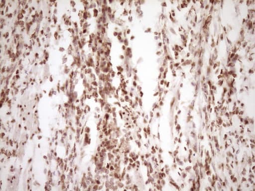 LPIN1 / Lipin 1 Antibody (clone OTI8F10)
