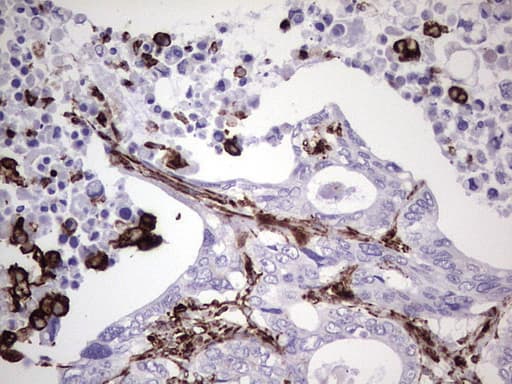 Vimentin Antibody (aa210-466, clone UMAB159)