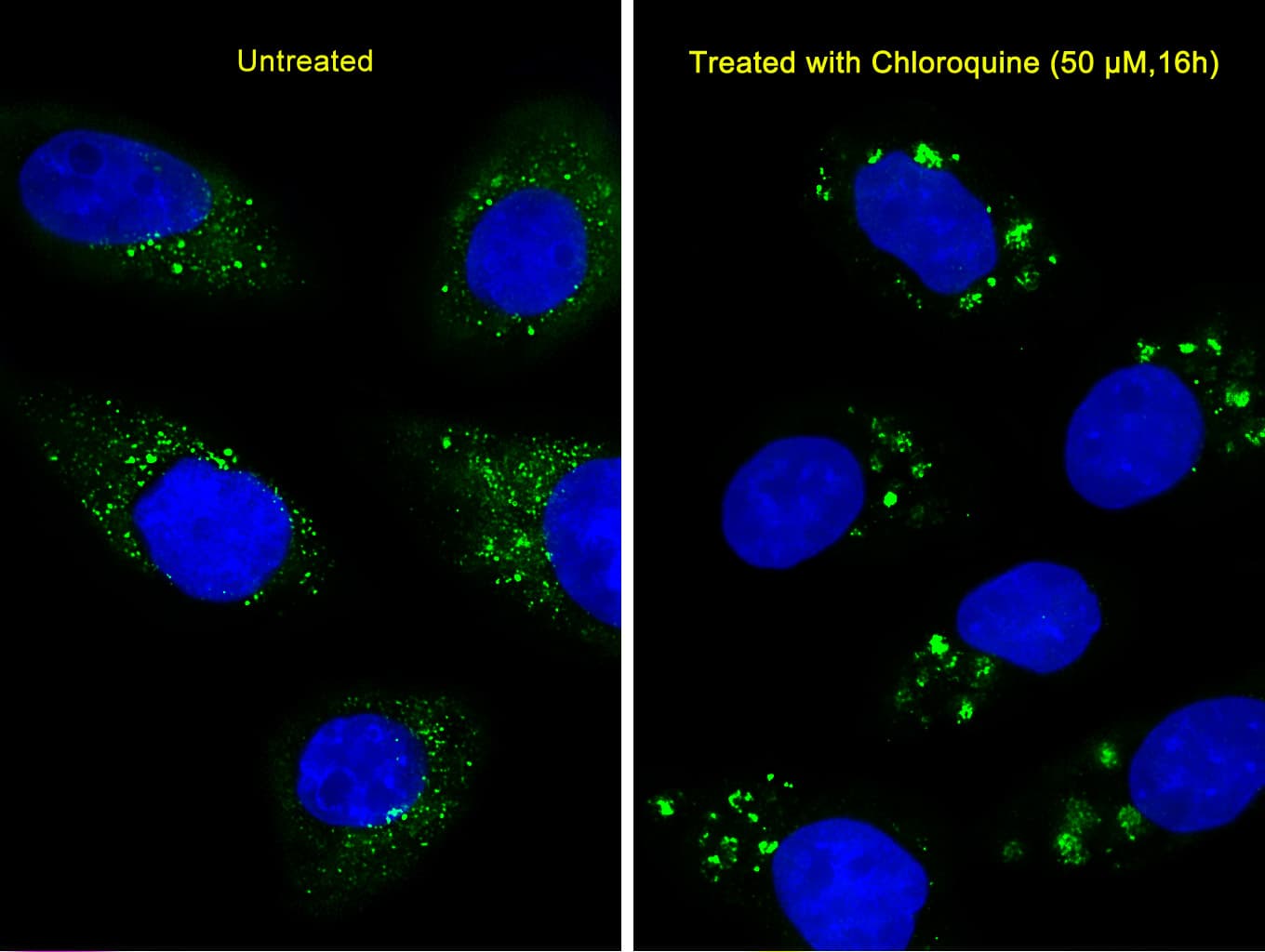 MAP1LC3A / LC3A Antibody