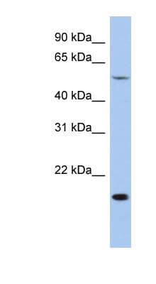 TEAD2 Antibody (aa323-372)