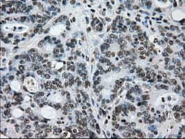 L1CAM Antibody (clone OTI2A6, Carrier-free)