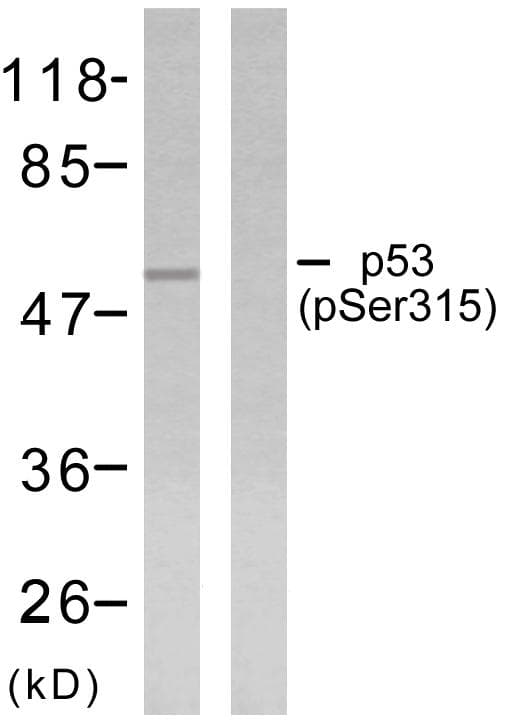 TP53 / p53 Antibody (phospho-Ser315)