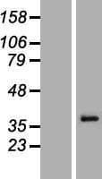 MAGEA6 Protein (Over-Expression Lysate Myc-DDK (Flag))