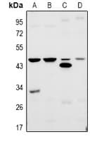 TBPL2 / TRF3 Antibody