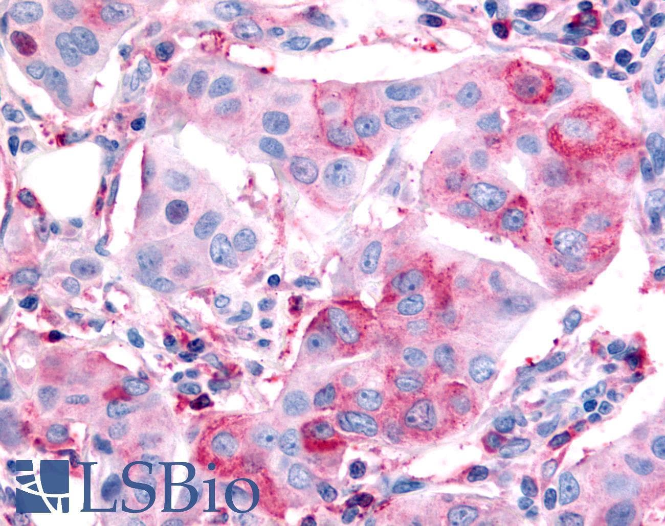 PathPlus™ Polyclonal Rabbit anti-Human P2RY12 / P2Y12 Antibody (N-Terminus, IHC)