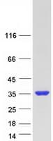 Human FAM9B Protein (Recombinant Myc-DDK (Flag))