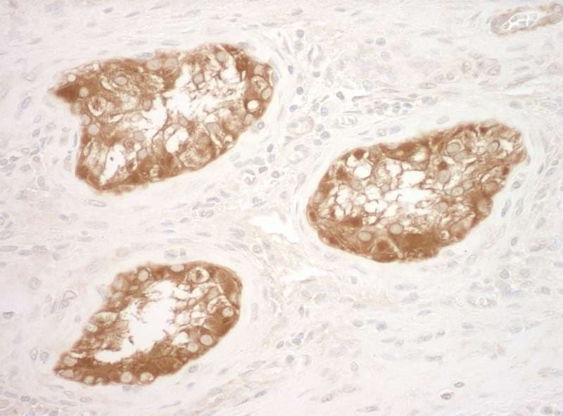 Polyclonal Rabbit anti-Human VCL / Vinculin Antibody (aa1016-1066, IHC)