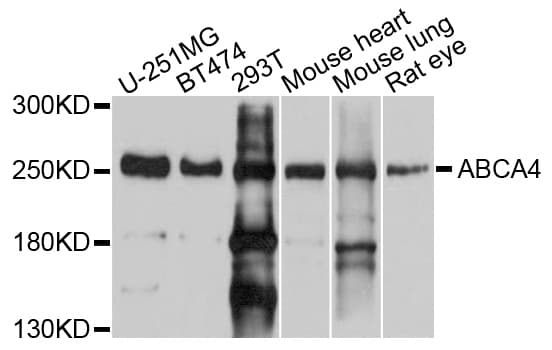 Polyclonal Rabbit anti-Human ABCA4 Antibody (WB)