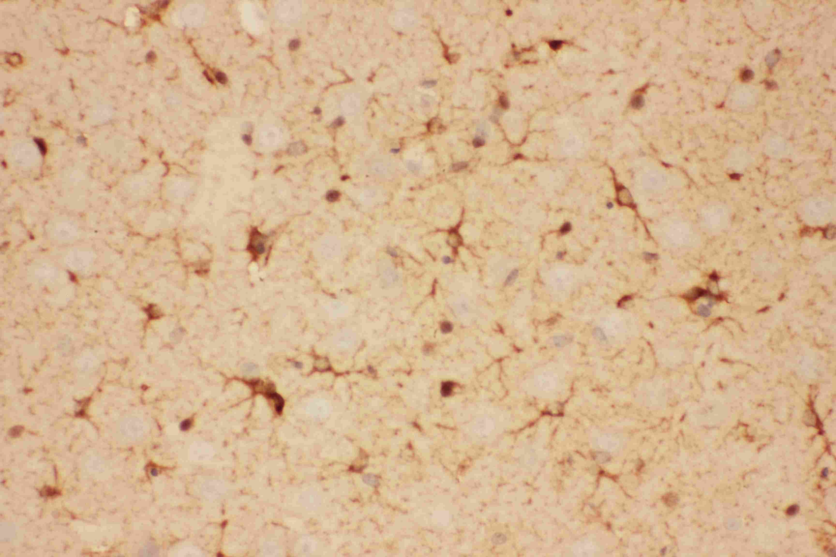 CNTF Antibody (aa2-198)