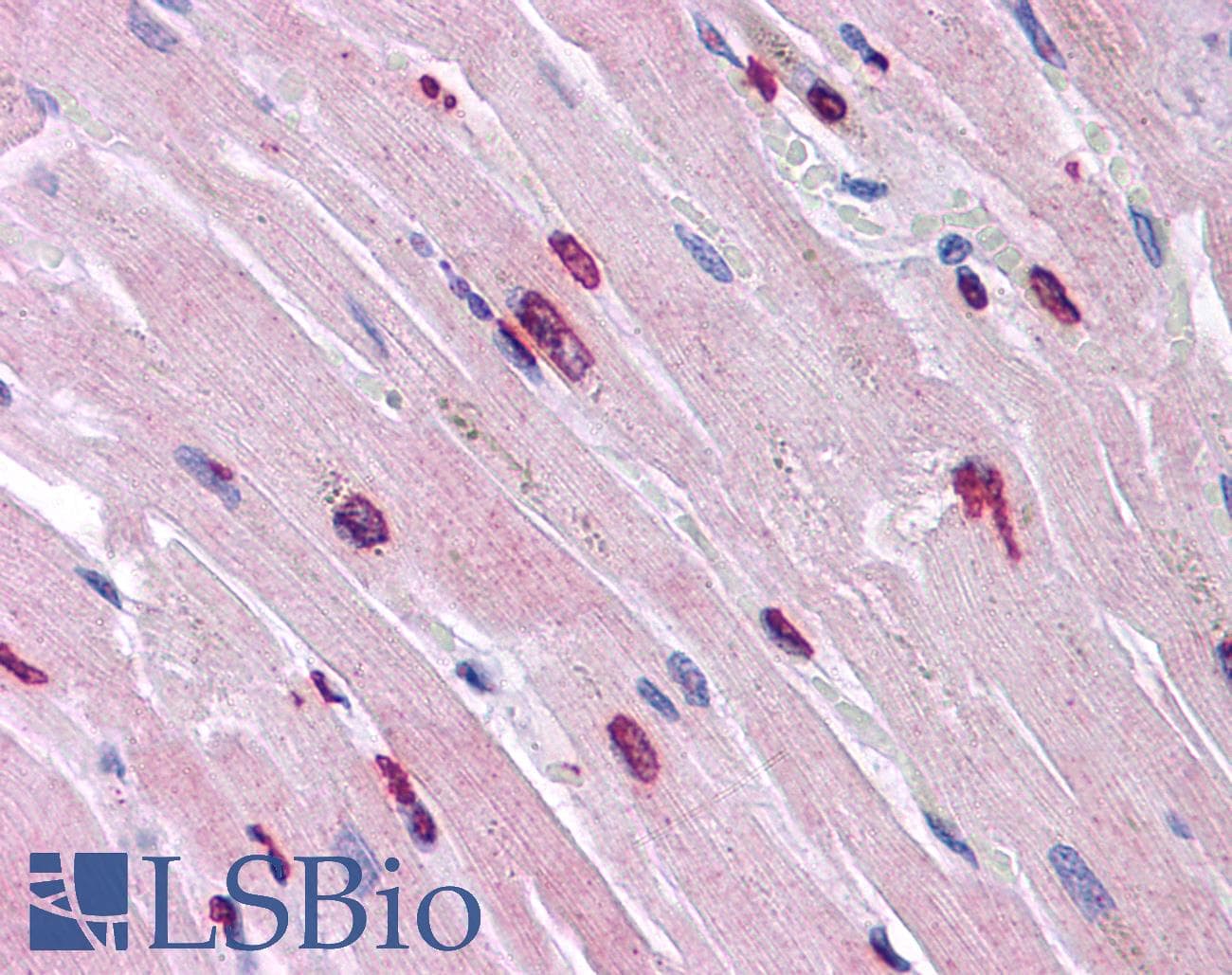 IHC-plus™ Polyclonal Rabbit anti-Human MINA / MINA53 Antibody (IHC, IF, WB)