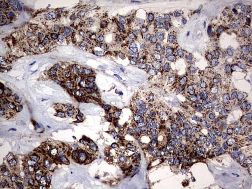 PIK3CD / PI3K Delta Antibody (aa286-610, clone OTI6A12)