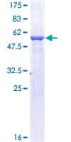 Human TPMT Protein (Recombinant GST)
