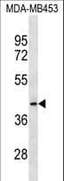 MRPL46 Antibody (aa248-274)