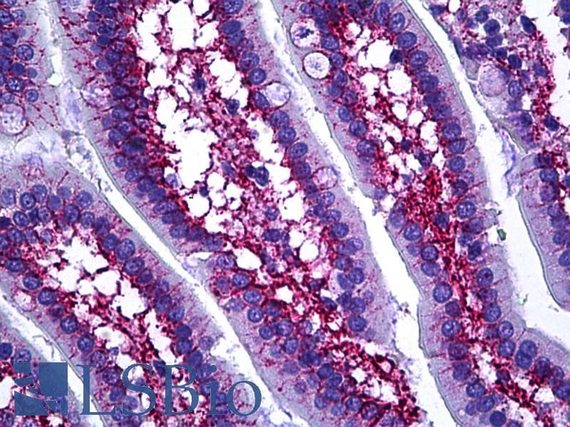 IHC-plus™ COL6A1 / Collagen VI Alpha 1 Antibody (aa191-240)