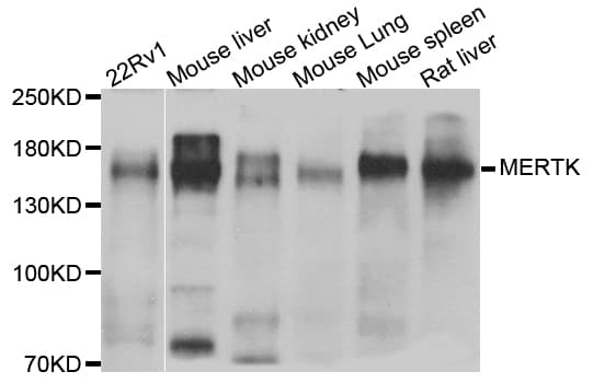 MER / MERTK Antibody