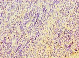 Polyclonal Rabbit anti-Human TERF2IP / RAP1 Antibody (aa1-280, IHC)