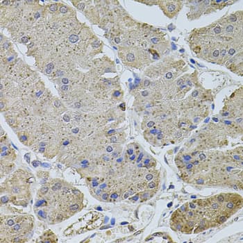 PLK4 / SAK Antibody
