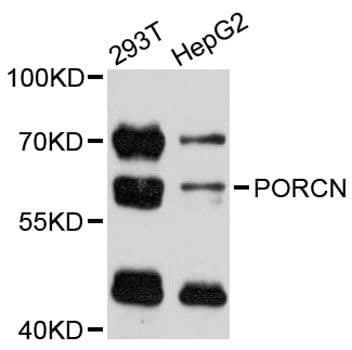 PORCN Antibody
