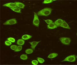 Monoclonal Mouse anti-Human HSPA5 / GRP78 / BiP Antibody (IHC, WB)