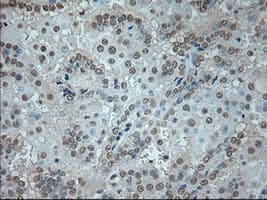 Monoclonal Mouse anti-Human GAD1 / GAD67 Antibody (clone OTI3G9, IHC, WB)