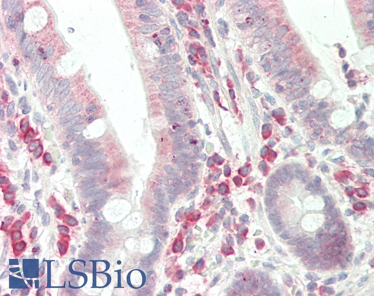 IHC-plus™ EF1G / EEF1G Antibody (aa200-250)