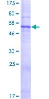Human SLC25A38 Protein (Recombinant GST)
