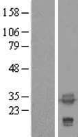 TPM4 Protein (Over-Expression Lysate Myc-DDK (Flag))