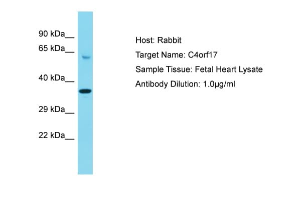 Polyclonal Rabbit anti-Human C4orf17 Antibody (aa136-185, WB)