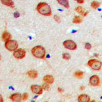 GAS6 Antibody (Internal)