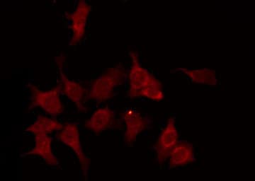 OR13C4 / OR2K1 Antibody