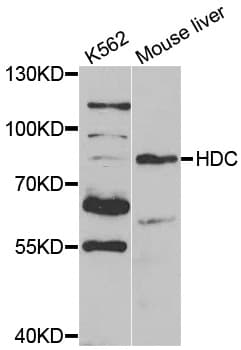 HDC / Histidine Decarboxylase Antibody (aa453-662)