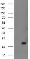 RBP1 / CRBP Antibody (clone OTI2H3)