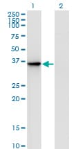 Monoclonal Mouse anti-Human AKR1D1 Antibody (clone 1A6, WB)