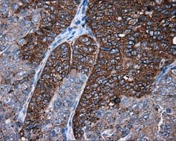 PIM2 / Pim-2 Antibody (clone OTI8G10)