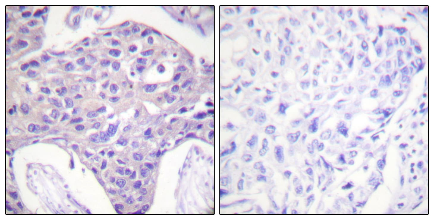 FOXO1+3+4 Antibody (N-Terminus)