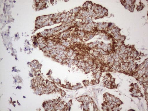 VISA / MAVS Antibody (aa1-247, clone OTI9C4)
