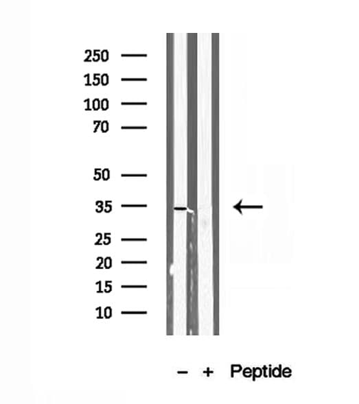 SULT1E1 / Sulfotransferase 1E1 Antibody
