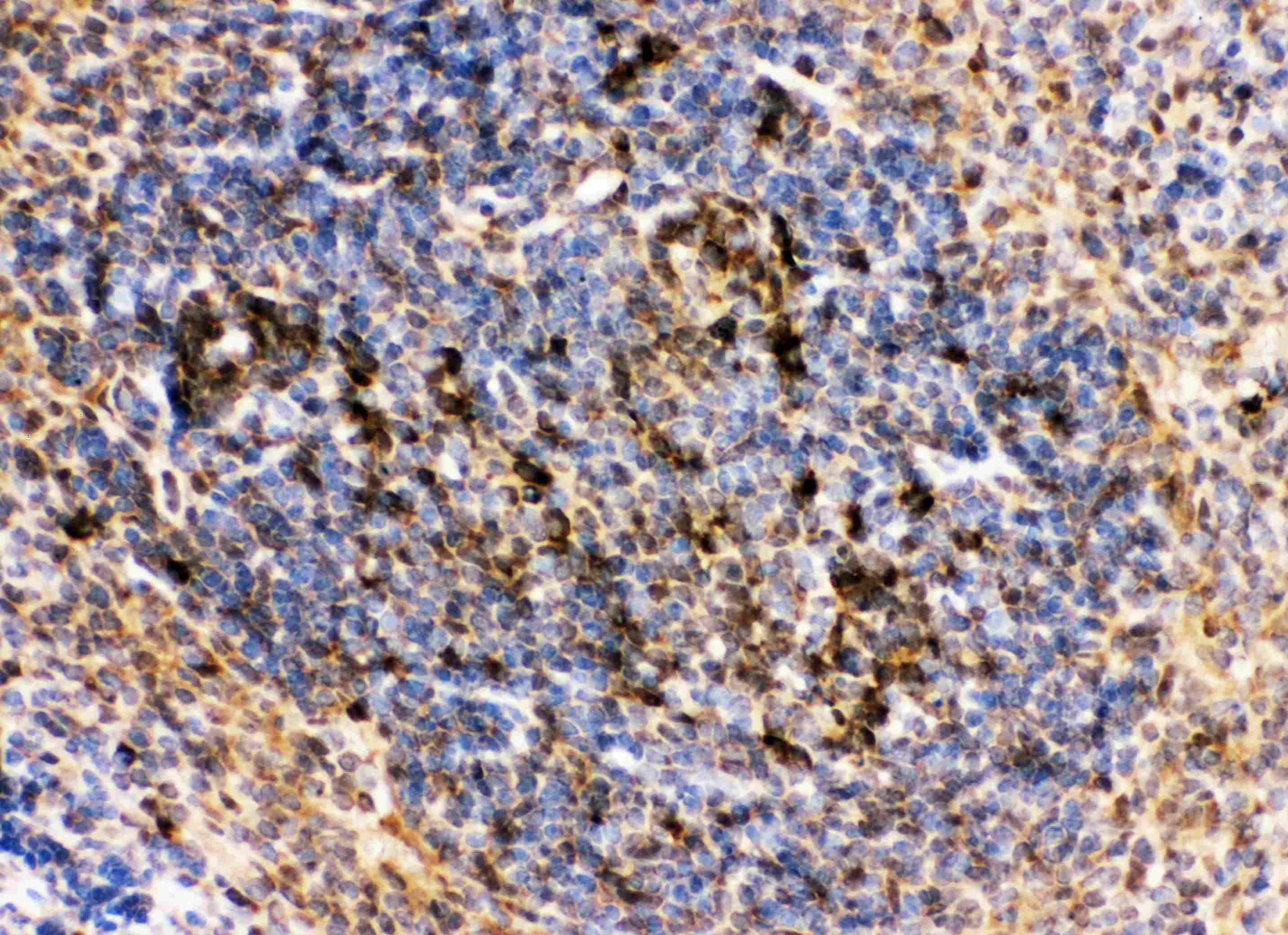 MME / CD10 Antibody (aa52-750)