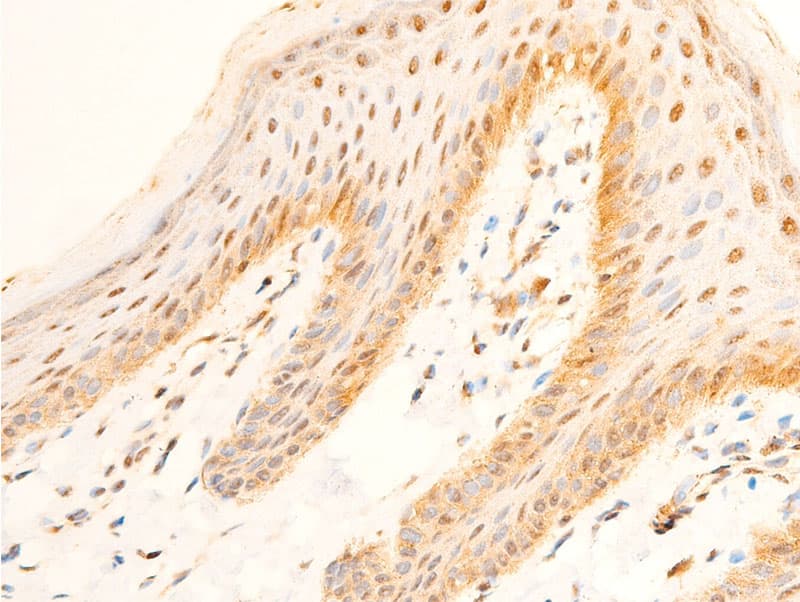Polyclonal Rabbit anti-Human FOXO3 / FOXO3A Antibody (phospho-Ser253, IHC, WB)