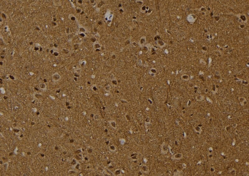 HIST1H2AE Antibody (Acetyl-Lys9)