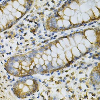 GSTM2 Antibody